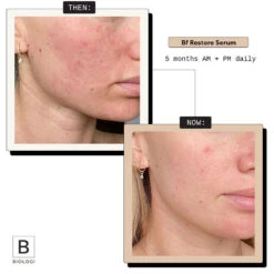 Biologi Bf Restore Face & Body Serum 100ml -Care Product Store BfBiologi Social ThenNow June2BB 403c97ca 8916 4988 a34f d3bf4577e23b