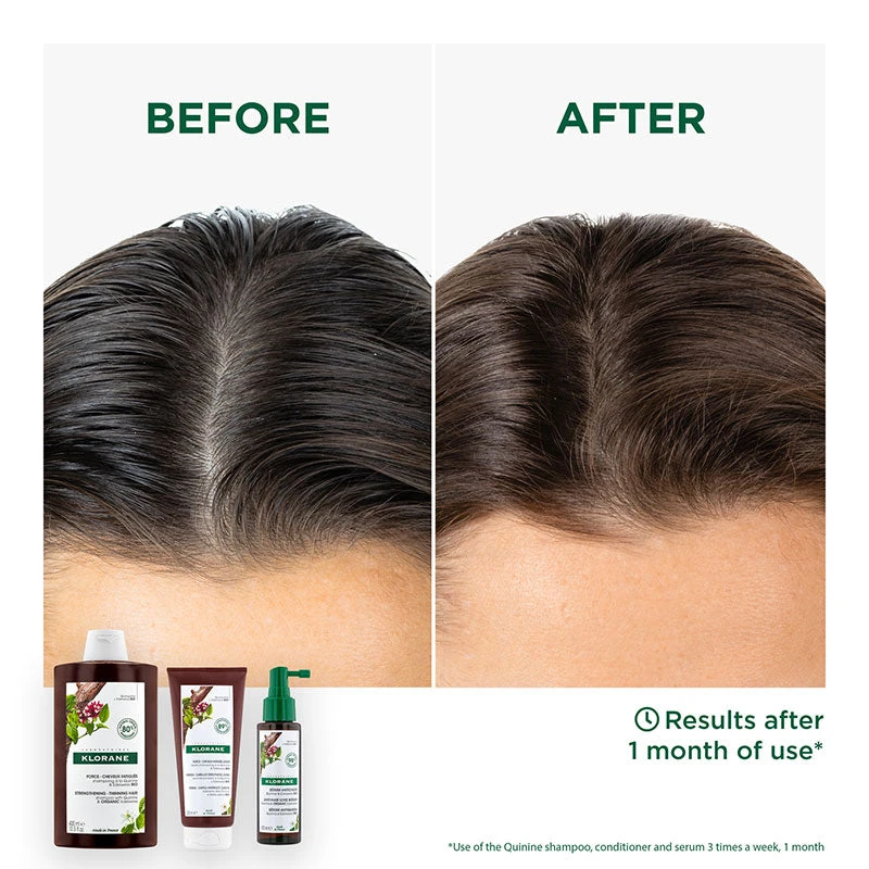 Klorane Strengthening Quinine & Organic Edelweiss Shampoo 400ml 4 Klorane Strengthening Quinine & Organic Edelweiss Shampoo 400ml - Image 4