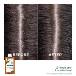 Klorane Anti-dandruff Rebalancing Shampoo With Galangal & AHA 400ml 11 Klorane Anti-dandruff Rebalancing Shampoo With Galangal & AHA 400ml -Care Product Store P0002244 4