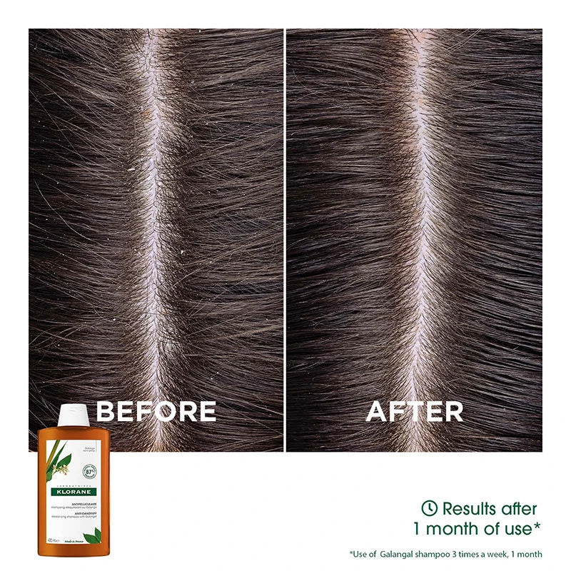 Klorane Anti-dandruff Rebalancing Shampoo With Galangal & AHA 400ml 4 Klorane Anti-dandruff Rebalancing Shampoo With Galangal & AHA 400ml - Image 4