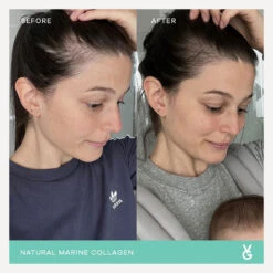 Vida Glow Original Marine Collagen Trial Pack 14 X 3g Sachets 9 Vida Glow Original Marine Collagen Trial Pack 14 X 3g Sachets -Care Product Store Vida Glow Original Marine Collagen Trial Pack 14 x 3g Sachets 2