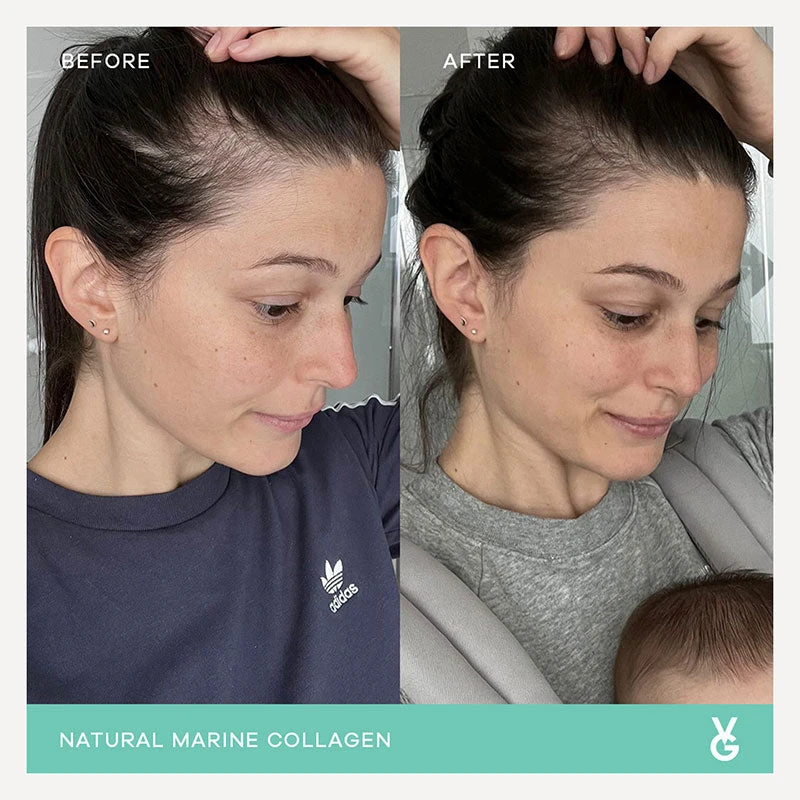 Vida Glow Original Marine Collagen Trial Pack 14 X 3g Sachets 4 Vida Glow Original Marine Collagen Trial Pack 14 X 3g Sachets - Image 4